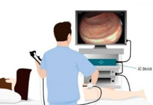 柳叶刀惊曝：AI让医生6个月“废功”20%，癌症检出率崩盘